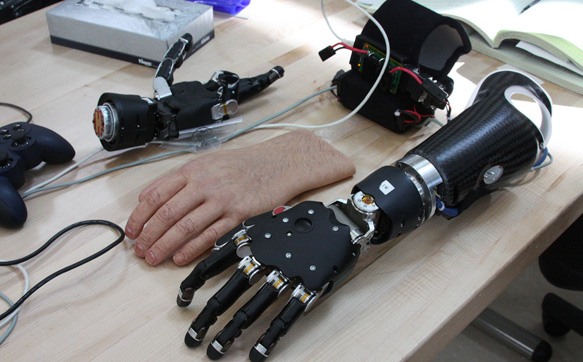 A brain-controlled prosthetic arm.