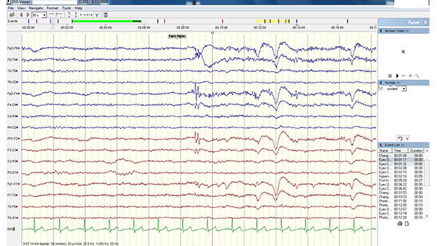 Screenshot of an EEG readout on a computer screen