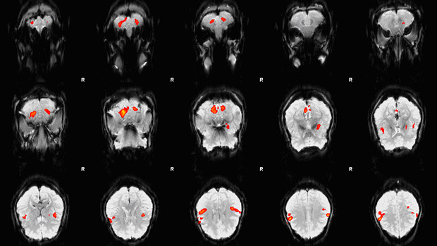Picture of an fMRI scan showing brain activity in particular locations of the brain