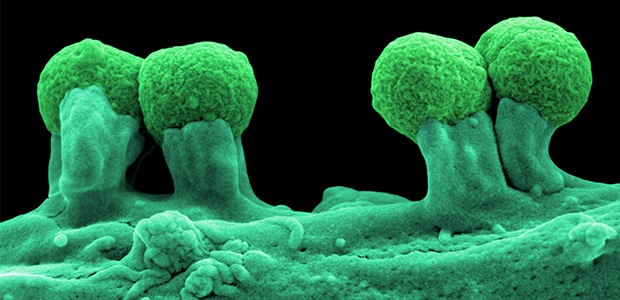 E. coli EPEC actin podests on fibroblast cell culture