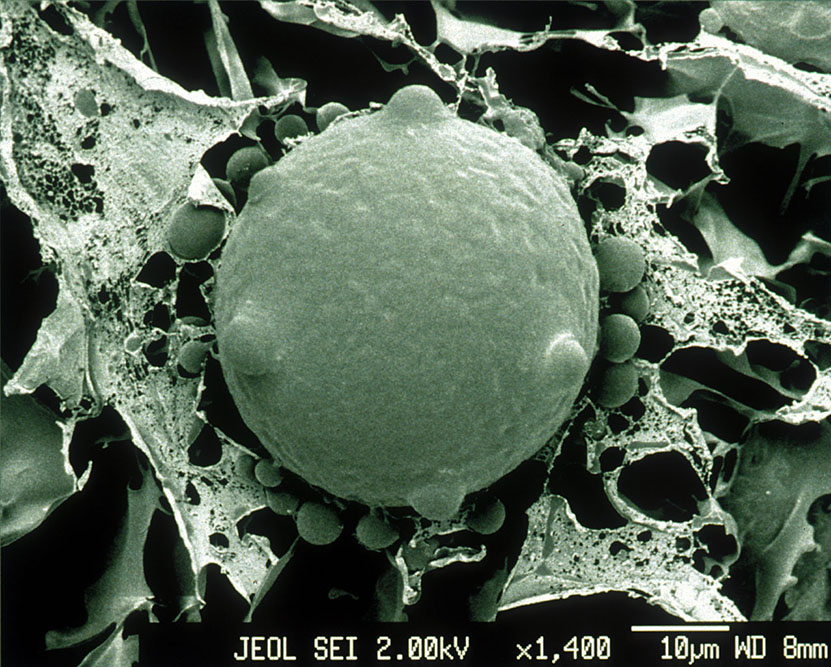 Electron micrograph of chytrid fungus