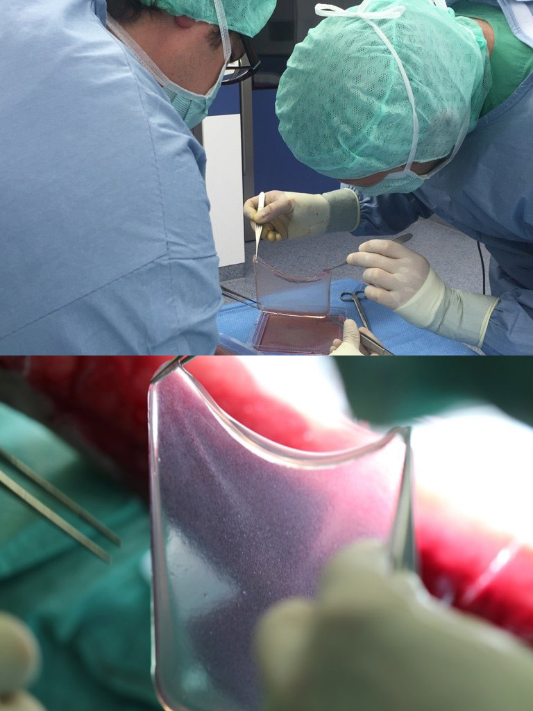 medical professionals preparing a transparent square of laboratory prepared skin