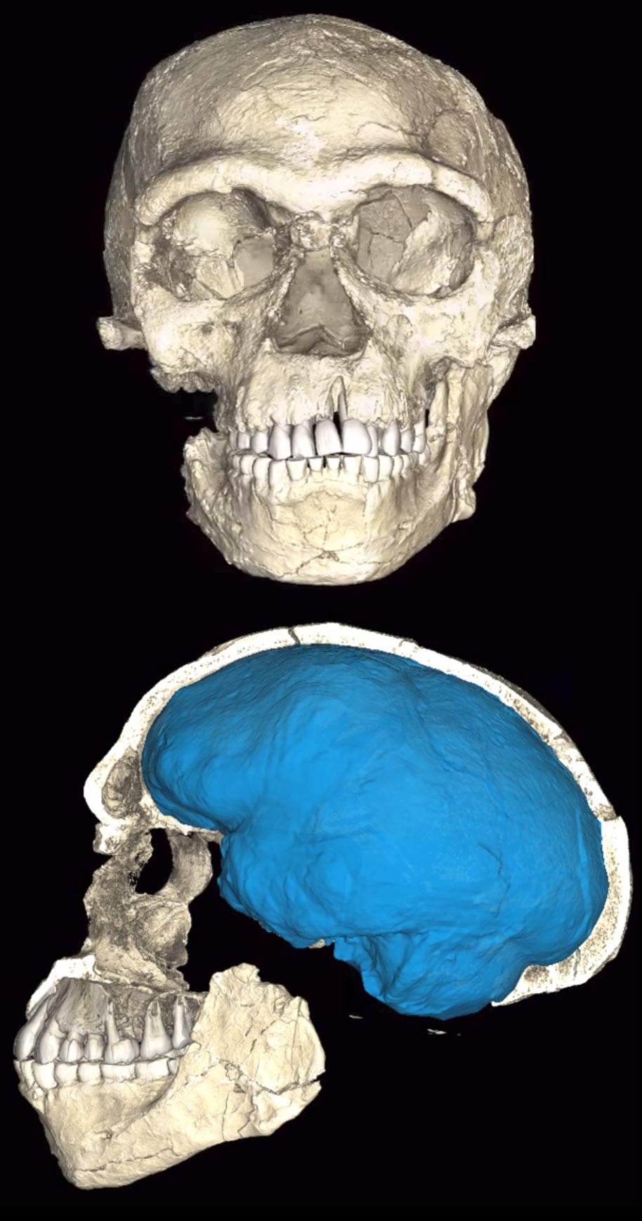 frontal and side view of ancient skull