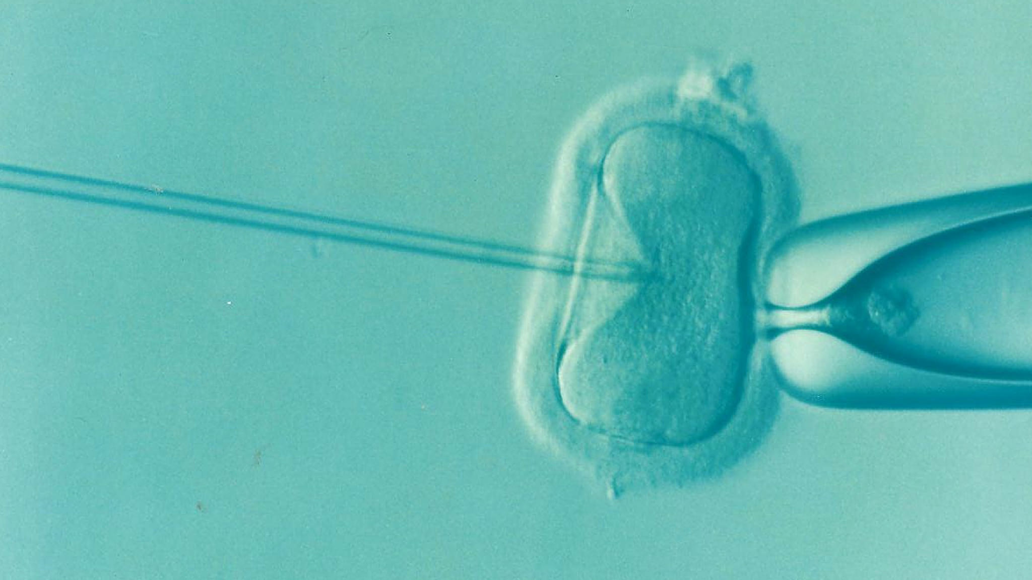 A micrograph of an egg being fertilised in IVF