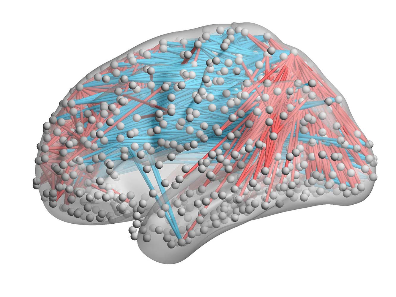 An computer image of the brain with many dots linked by coloured lines, indicating brain connectivity