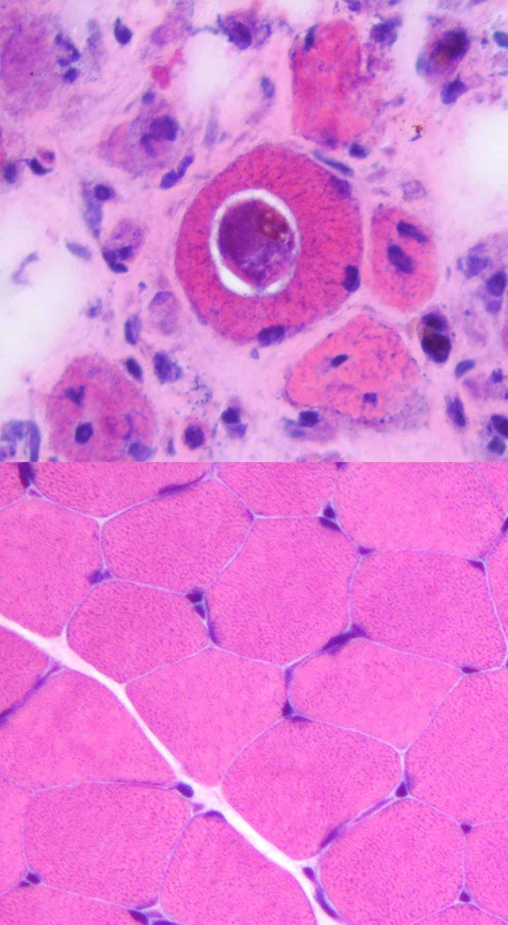 Cross-section of muscle fibre illustrating H. perplexum (dark purple) in individual muscle cells