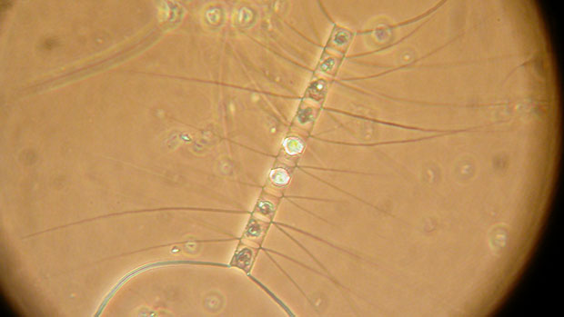 A photo of a microscope image of a diatom.