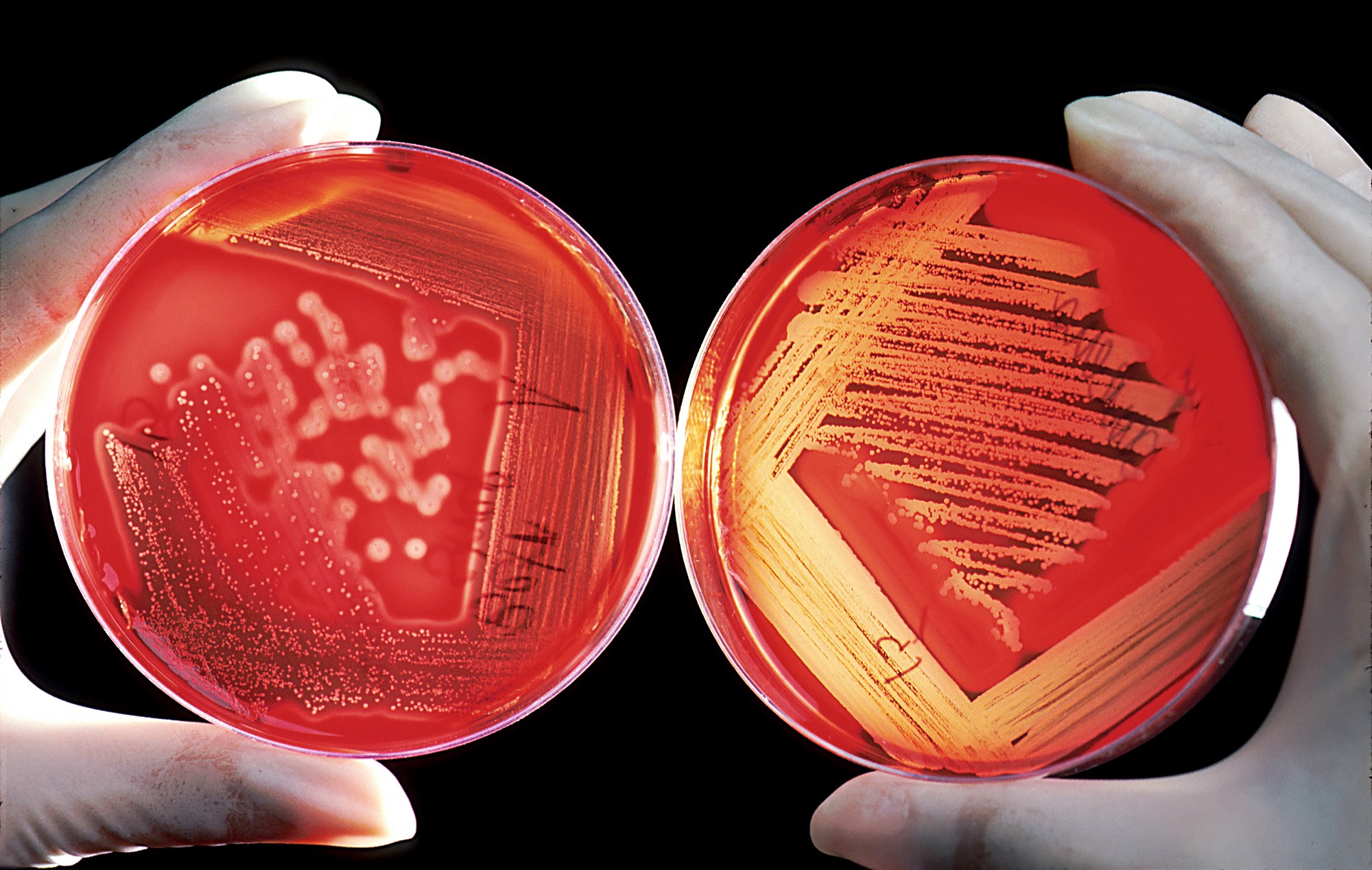 Two circular agar plates with visible colonies of microorganisms