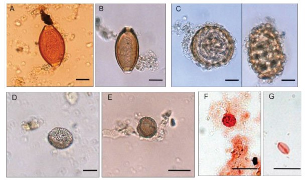 Microscopic images of microbes found in barrels of 700-year-old human waste in Belgium