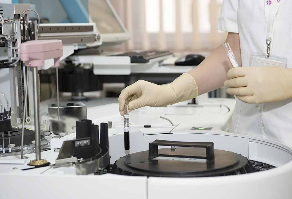 Testing blood samples in a laboratory