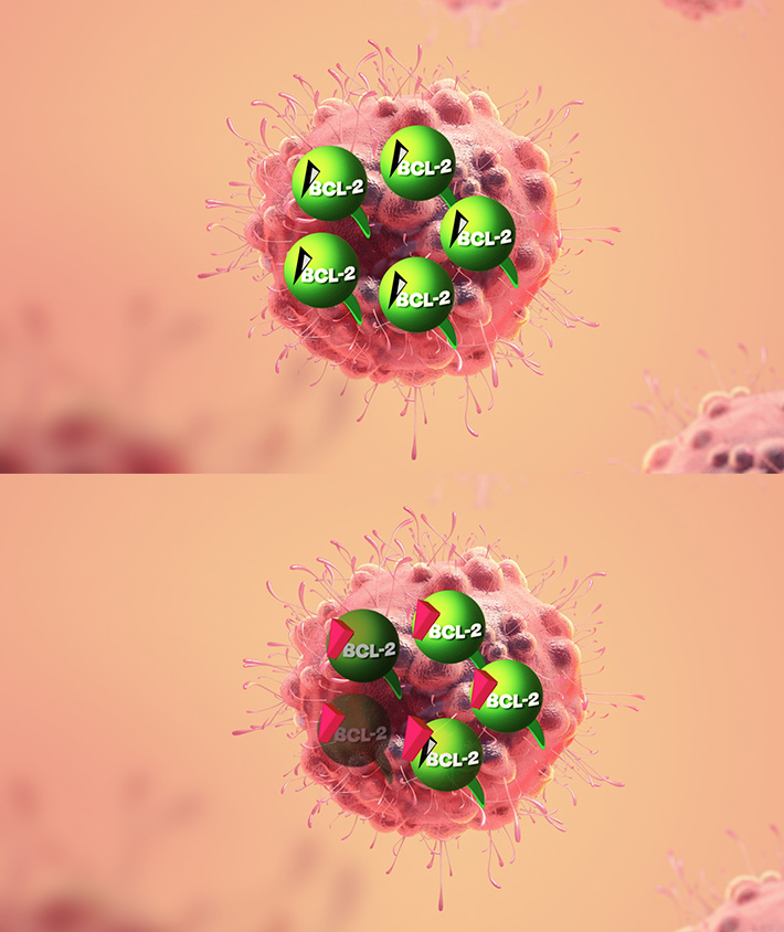 A diagram shows a cancer cell with BCL-2 proteins inside in two images. In the second picture the BCL-2 protein is changed and declining in number