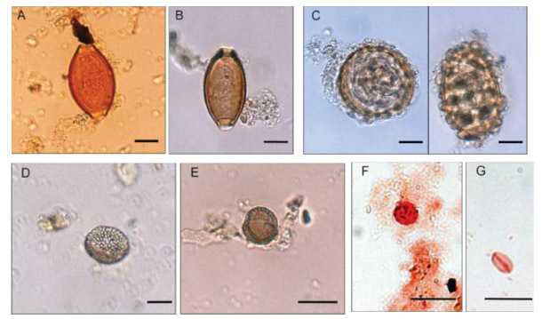 Photos of microbes under the microscope