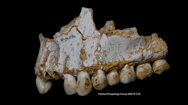 A Neanderthal upper jaw with dental calculus visible, found in Spain