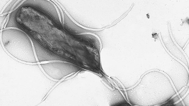 H. pylori