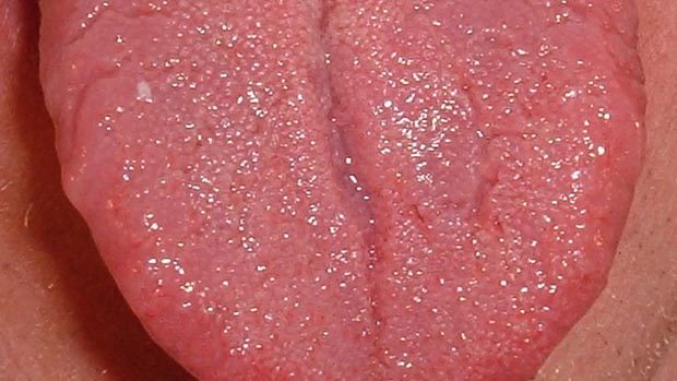 Close-up photograph of a human tongue