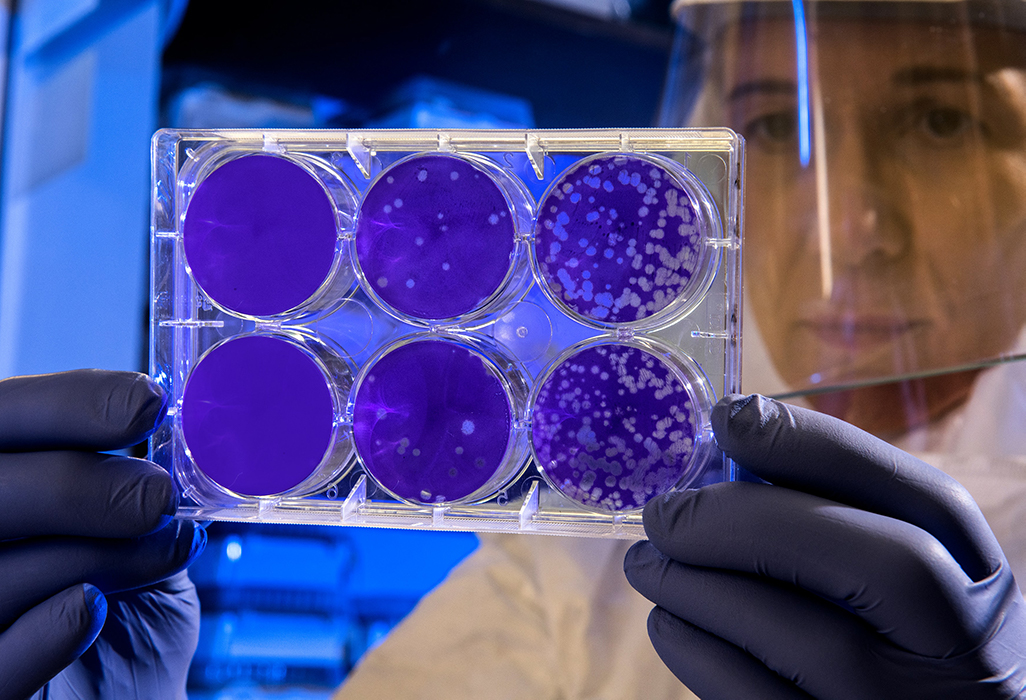 Scientist wearing face shield and gloves holds up viral culture plates